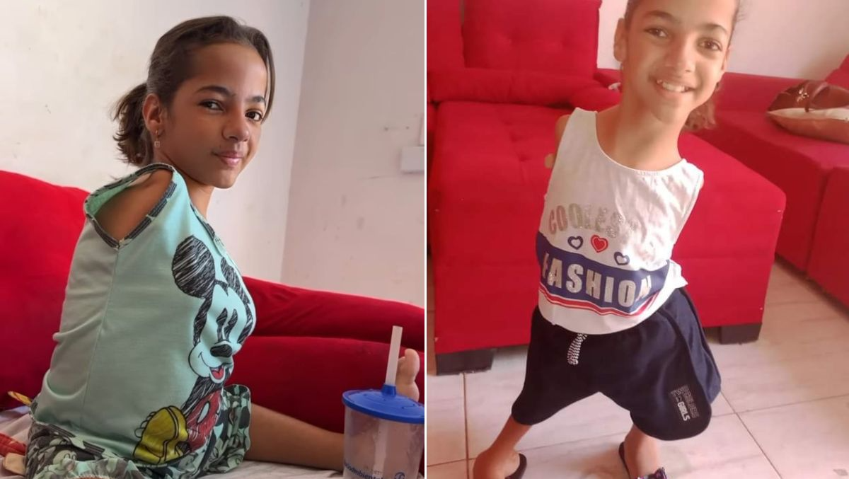 Menina que nasceu sem os braços passa necessidades com a mãe. Falta até comida em casa!